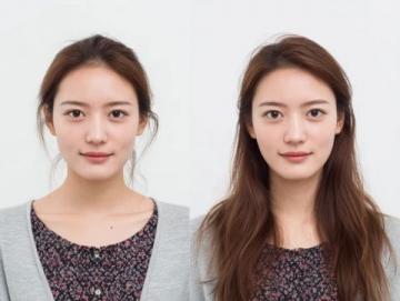 煙臺女子花費6萬元種植12顆牙兩年后全拆體重驟降引發熱議